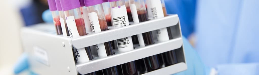 rabies titer test sample