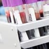 What is a rabies titer test